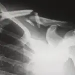 xray