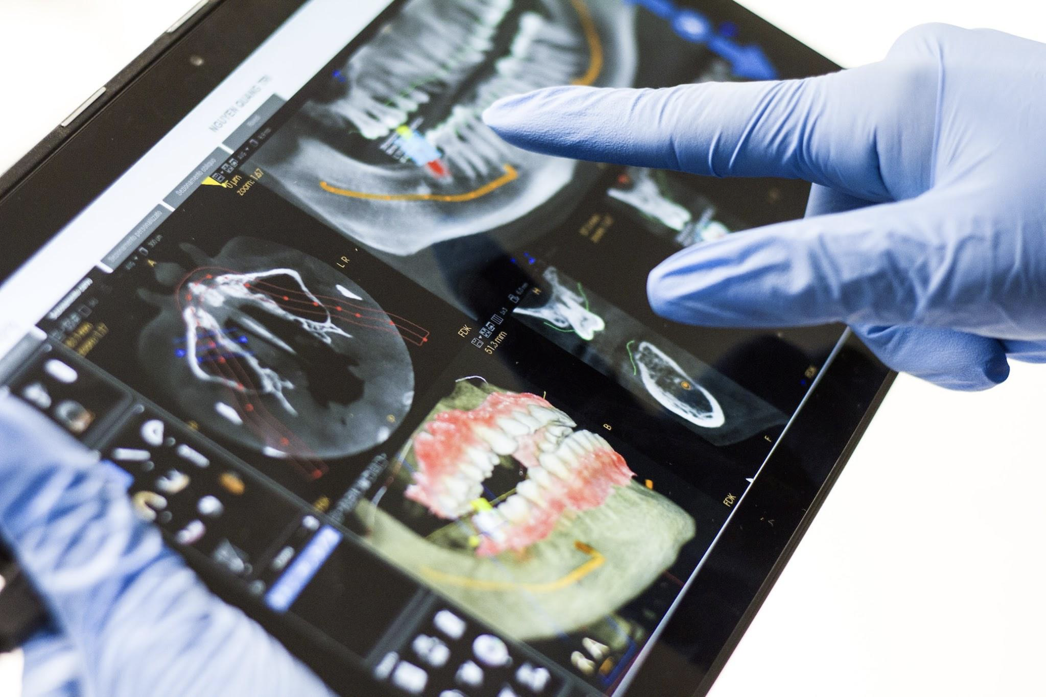 What To Do After Unexpected Dental Accident?