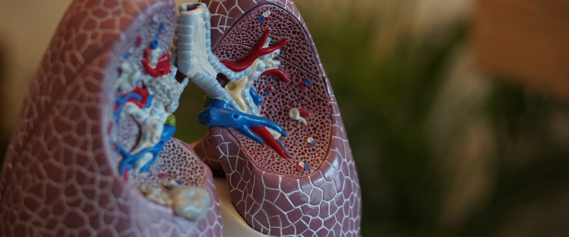 What To Expect When a Mesothelioma Diagnosis Is Explained