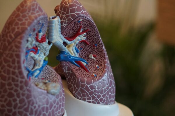 What To Expect When a Mesothelioma Diagnosis Is Explained